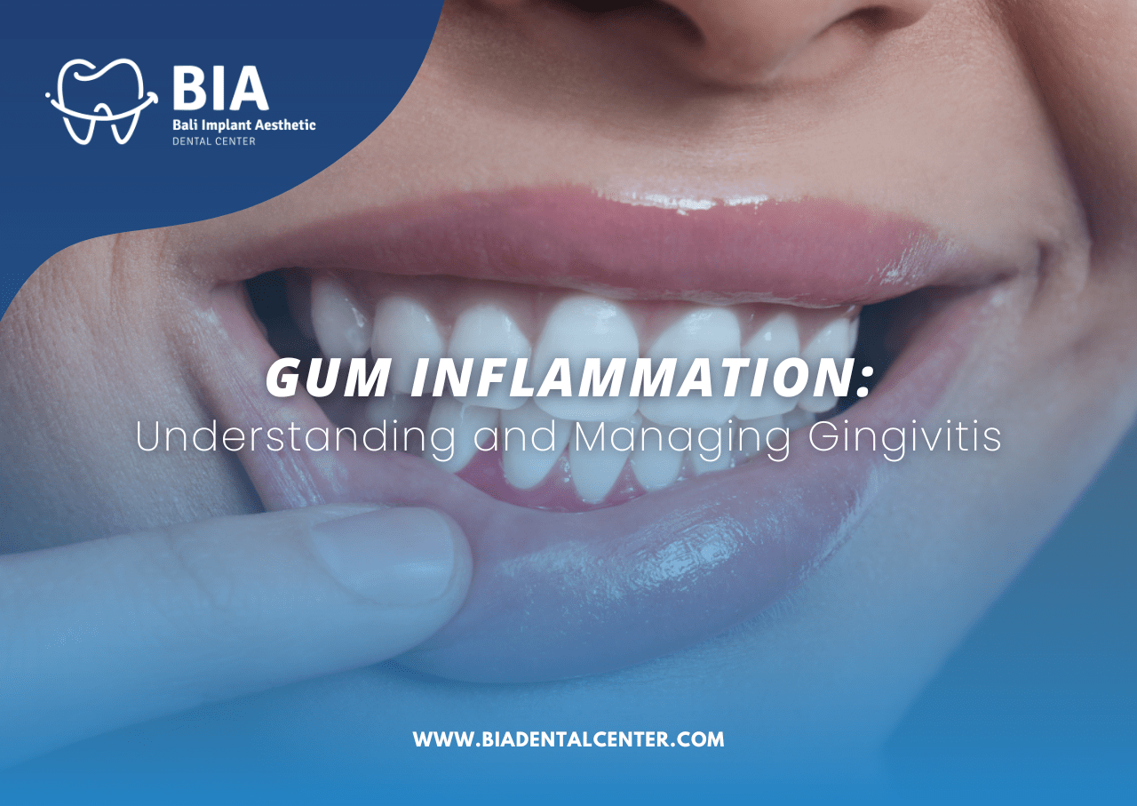 Gum Inflammation: Understanding and Managing Gingivitis