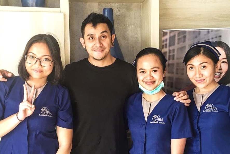 Vicky Nitinegoro known as aIndonesian  model an actor. review's at BIA Dental Center, best Bali Dental Center